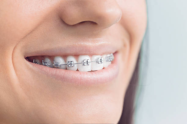 Best Invisalign and Clear Aligners  in Nth Plains, OR
